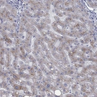 Anti-APOC3 Antibody