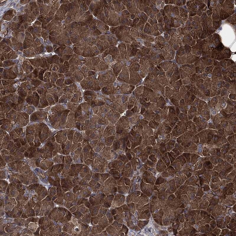 Anti-TPT1 Antibody