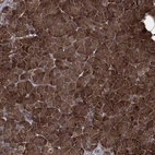 Anti-TPT1 Antibody