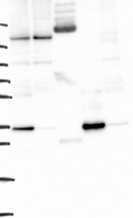 Anti-YIPF1 Antibody