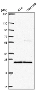 Western blot analysis in human cell line RT-4 and human cell line U-251 MG.
