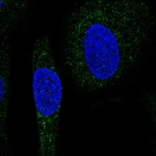 Anti-SNX24 Antibody
