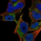 Immunofluorescent staining of human cell line SK-MEL-30 shows localization to nucleoplasm, plasma membrane & the Golgi apparatus.