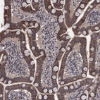 Anti-MRPS24 Antibody