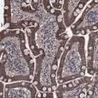 Anti-MRPS24 Antibody