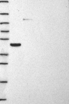 Anti-STARD3 Antibody