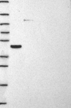 Anti-STARD3 Antibody
