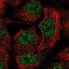 Immunofluorescent staining of human cell line A549 shows localization to nucleoplasm & vesicles.