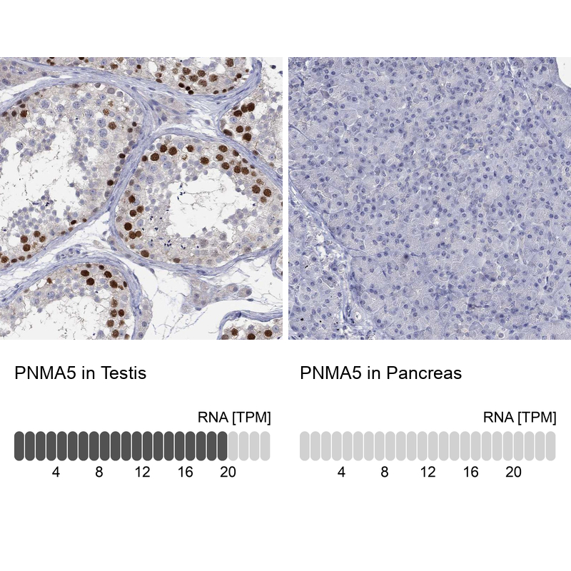 Anti-PNMA5 Antibody