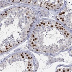 Immunohistochemical staining of human testis shows high expression.