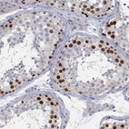 Anti-PNMA5 Antibody