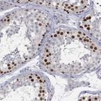 Immunohistochemical staining of human testis shows high expression.