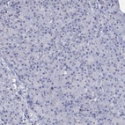 Immunohistochemical staining of human pancreas shows low expression as expected.