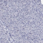 Immunohistochemical staining of human pancreas shows low expression as expected.
