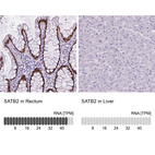 Anti-SATB2 Antibody