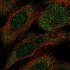 Immunofluorescent staining of human cell line U-2 OS shows localization to cytosol.