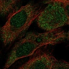 Immunofluorescent staining of human cell line U-2 OS shows localization to cytosol.