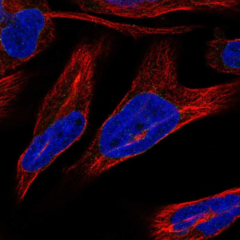 Anti-NRM Antibody