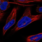 Anti-NRM Antibody