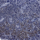 Immunohistochemical staining of human tonsil shows high expression.