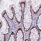 Immunohistochemical staining of human rectum shows strong nuclear positivity in glandular cells.