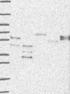 Lane 1: Marker [kDa] 250, 130, 95, 72, 55, 36, 28, 17, 10 | Lane 2: RT4 | Lane 3: U-251 MG | Lane 4: Human Plasma | Lane 5: Liver | Lane 6: Tonsil