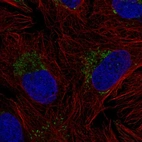 Anti-ZNF625 Antibody