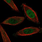 Anti-NFAT5 Antibody