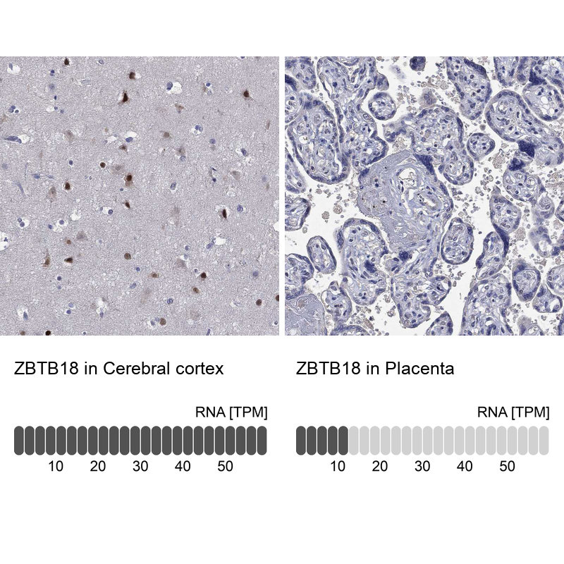 Anti-ZBTB18 Antibody