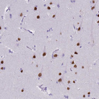 Immunohistochemical staining of human cerebral cortex shows strong nuclear positivity in neurons.