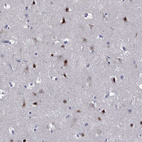 Immunohistochemical staining of human cerebral cortex shows moderate to strong nuclear positivity in neurons.