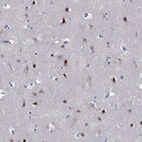 Immunohistochemical staining of human cerebral cortex shows moderate to strong nuclear positivity in neurons.