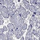 Immunohistochemical staining of human placenta shows no positivity in trophoblastic cells as expected.