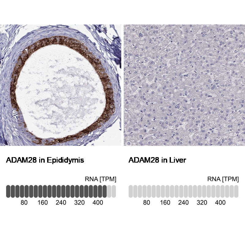Anti-ADAM28 Antibody