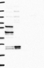 Lane 1: Marker [kDa] 250, 130, 95, 72, 55, 36, 28, 17, 10 | Lane 2: RT4 | Lane 3: U-251 MG | Lane 4: Human Plasma | Lane 5: Liver | Lane 6: Tonsil