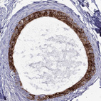 Immunohistochemical staining of human epididymis shows strong cytoplasmic and membranous positivity in glandular cells.