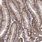 Immunohistochemical staining of human stomach shows strong membranous positivity in glandular cells.