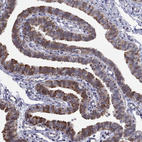Immunohistochemical staining of human fallopian tube shows strong membranous positivity in glandular cells.