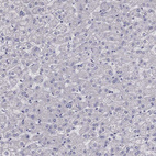 Immunohistochemical staining of human liver shows no positivity in hepatocytes as expected.