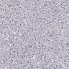 Immunohistochemical staining of human liver shows no positivity in hepatocytes as expected.