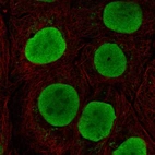 Anti-SOX15 Antibody