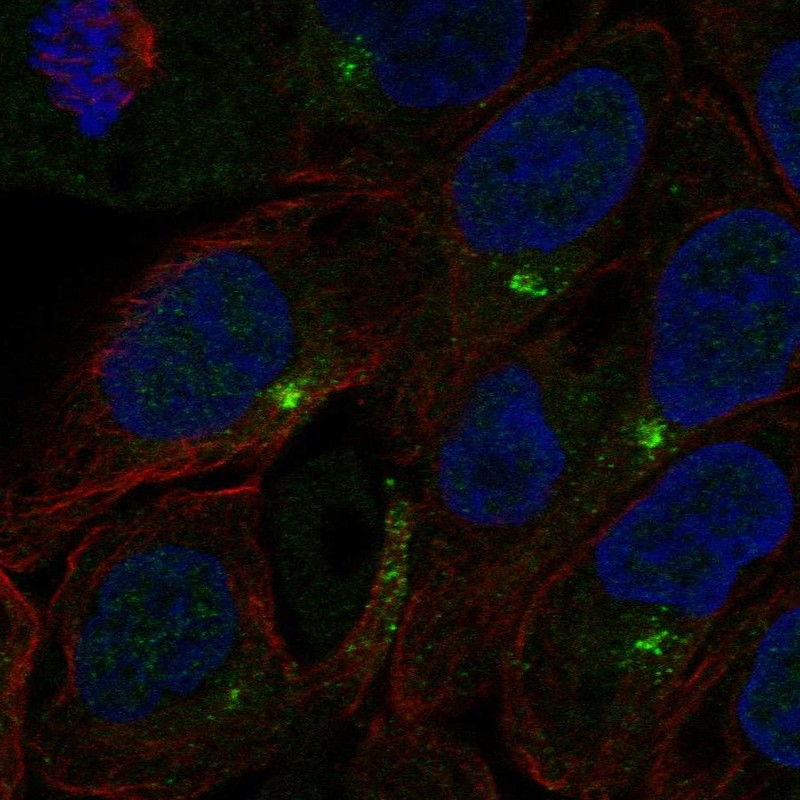 Anti-C1orf146 Antibody