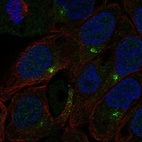Anti-C1orf146 Antibody
