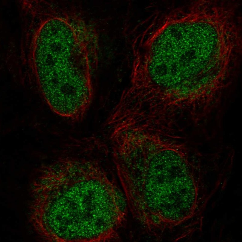 Anti-ZBTB47 Antibody