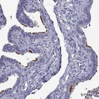 Immunohistochemical staining of human fallopian tube shows high expression.