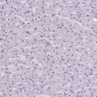 Immunohistochemical staining of human liver shows no positivity in hepatocytes as expected.