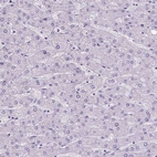 Immunohistochemical staining of human liver shows no positivity in hepatocytes as expected.