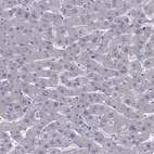 Anti-CFAP91 Antibody