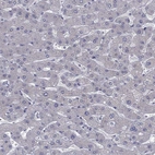 Immunohistochemical staining of human liver shows low expression as expected.