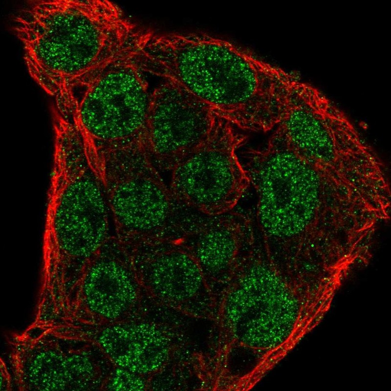 Anti-SOCS1 Antibody
